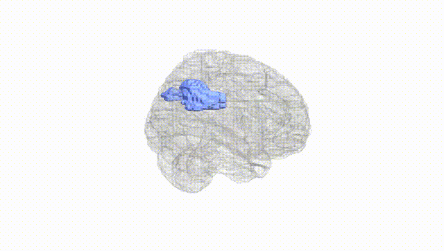 Full Brain White