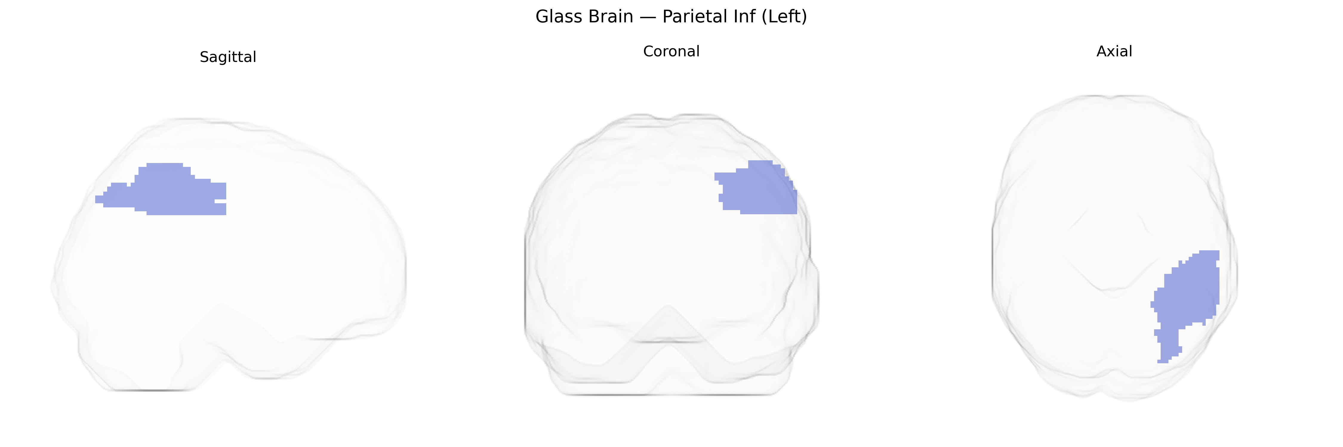 Triplanar Ghost Brain