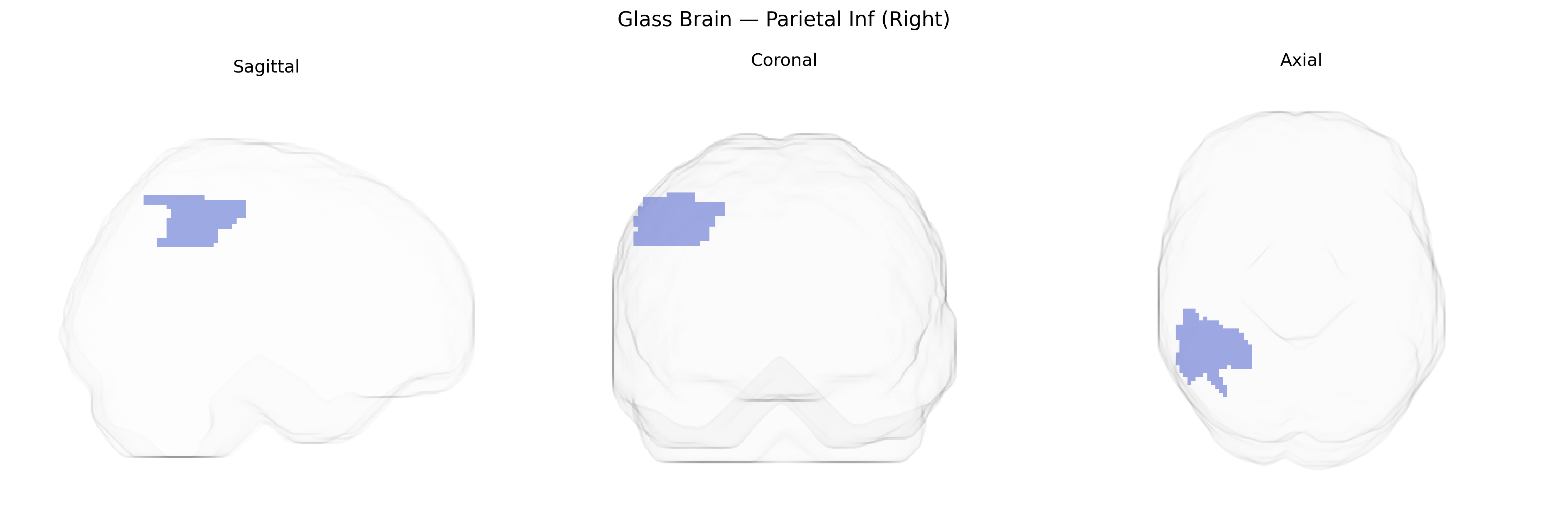 Triplanar Ghost Brain