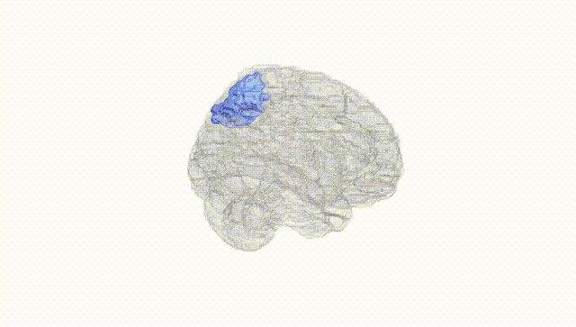 Full Brain White