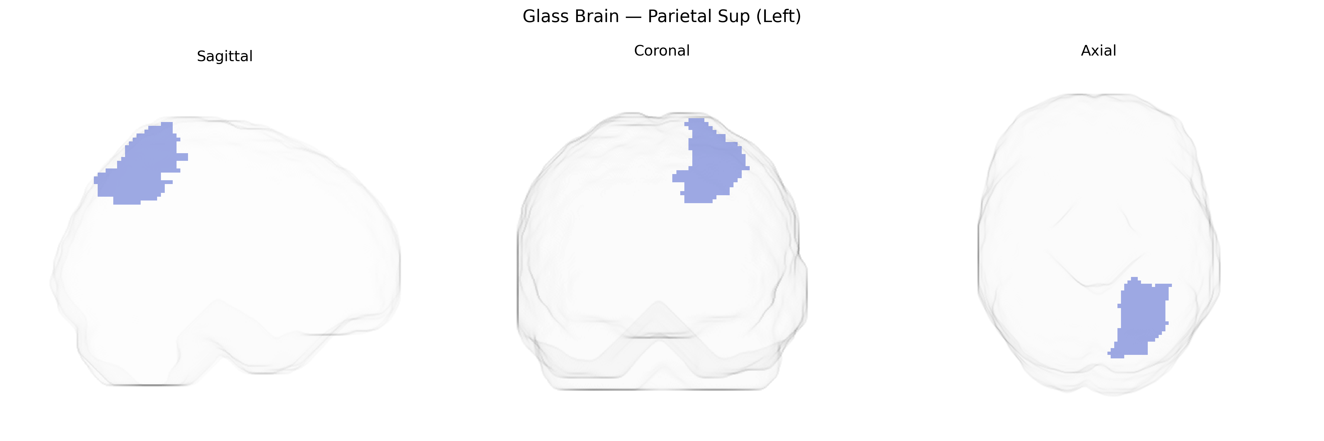 Triplanar Ghost Brain