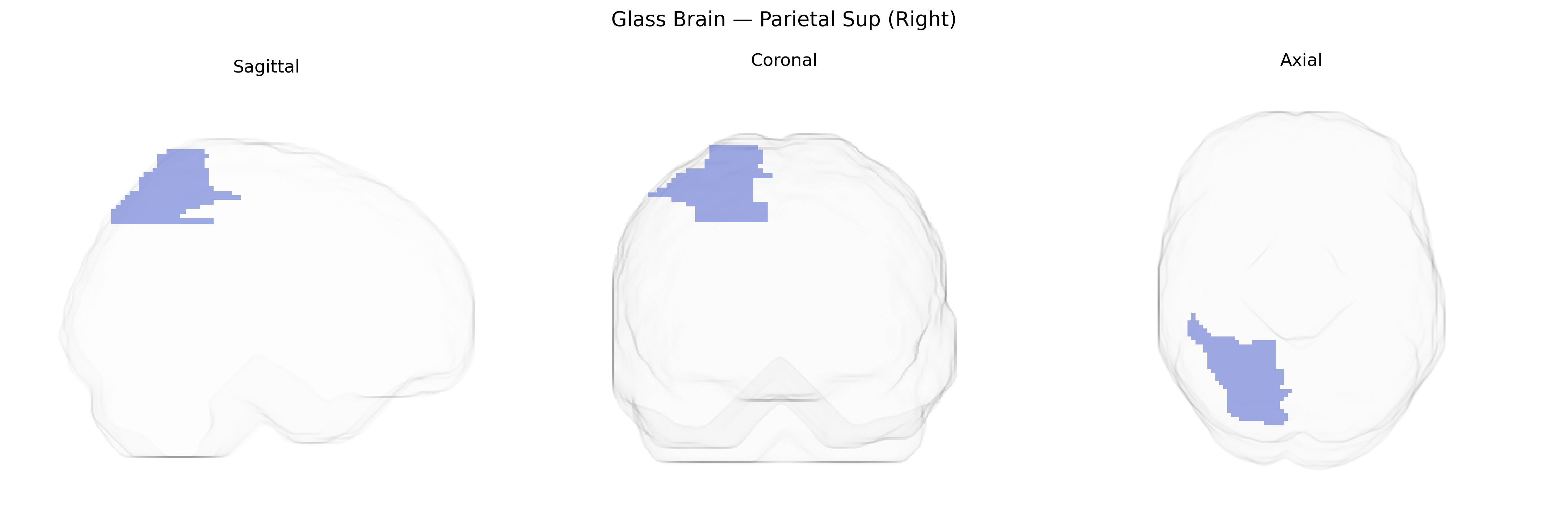 Triplanar Ghost Brain