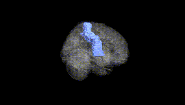 Full Brain Black