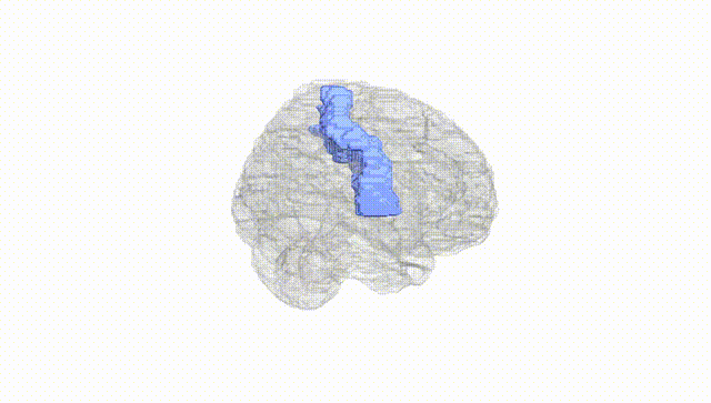 Full Brain White