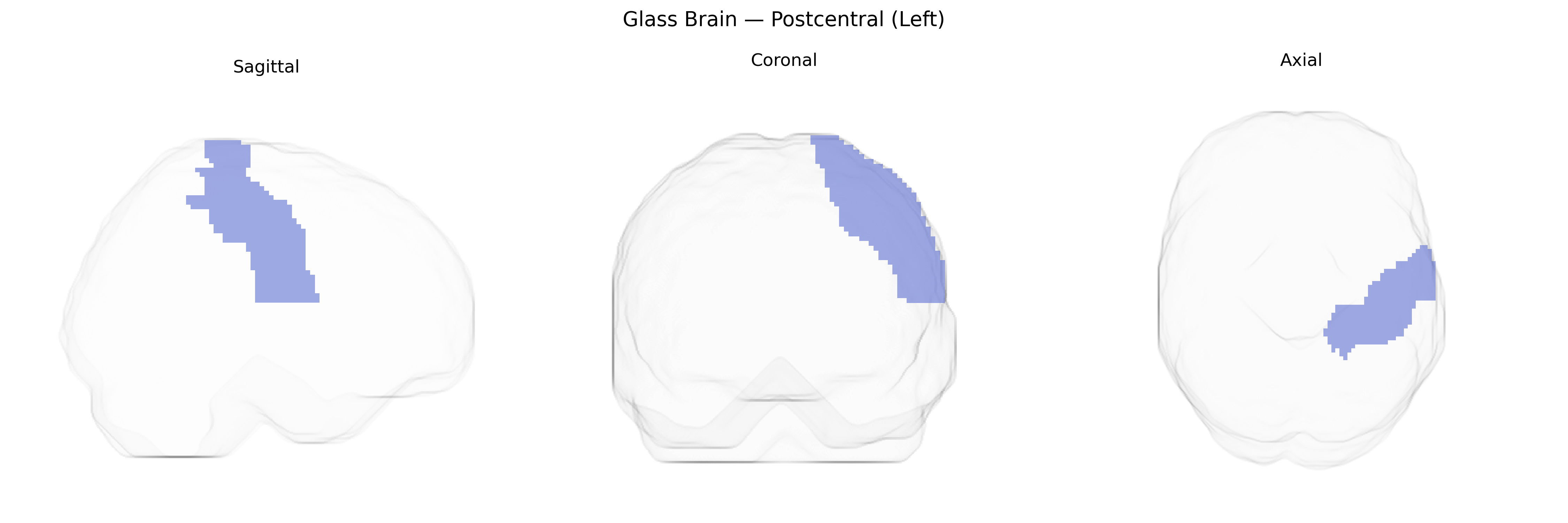 Triplanar Ghost Brain