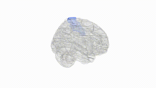 Full Brain White