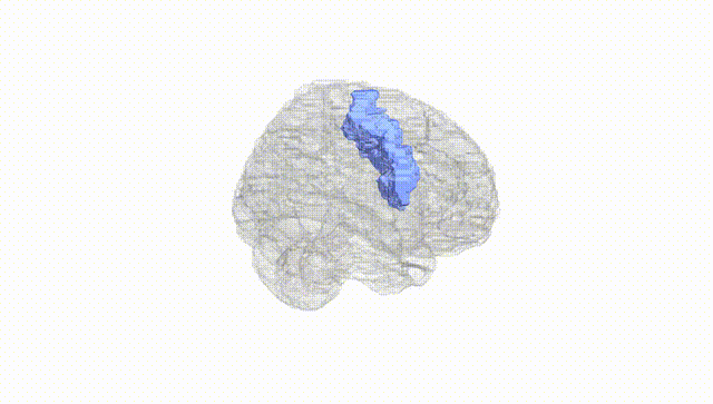 Full Brain White