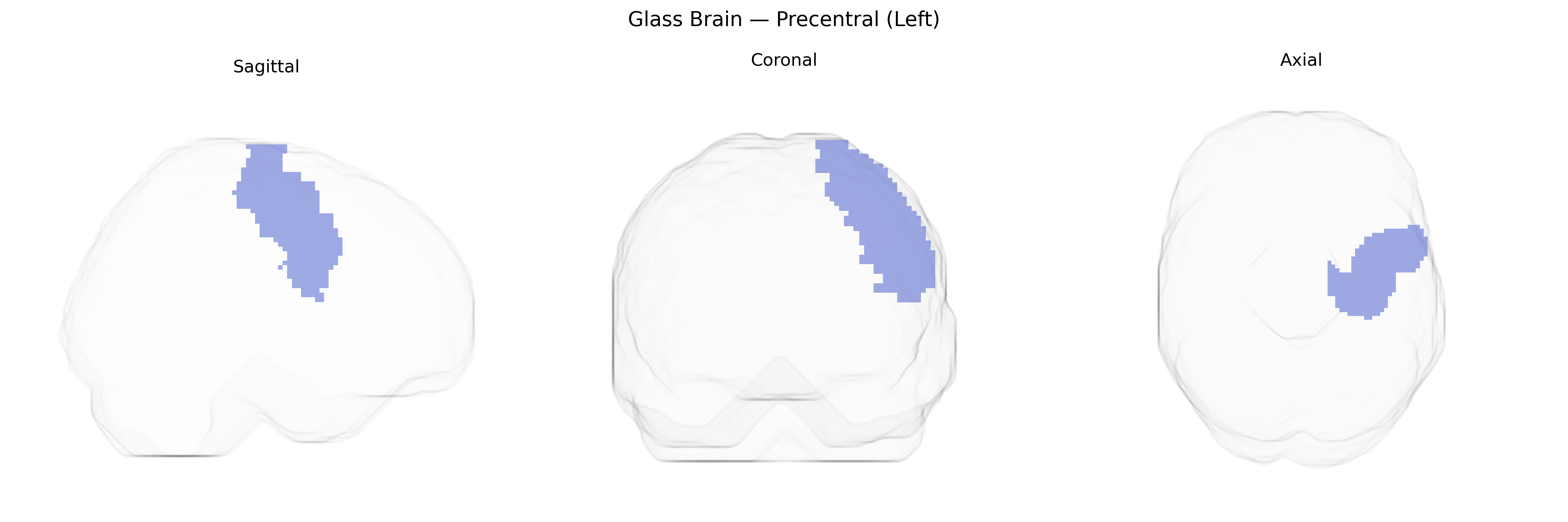 Triplanar Ghost Brain