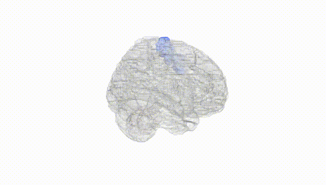 Full Brain White