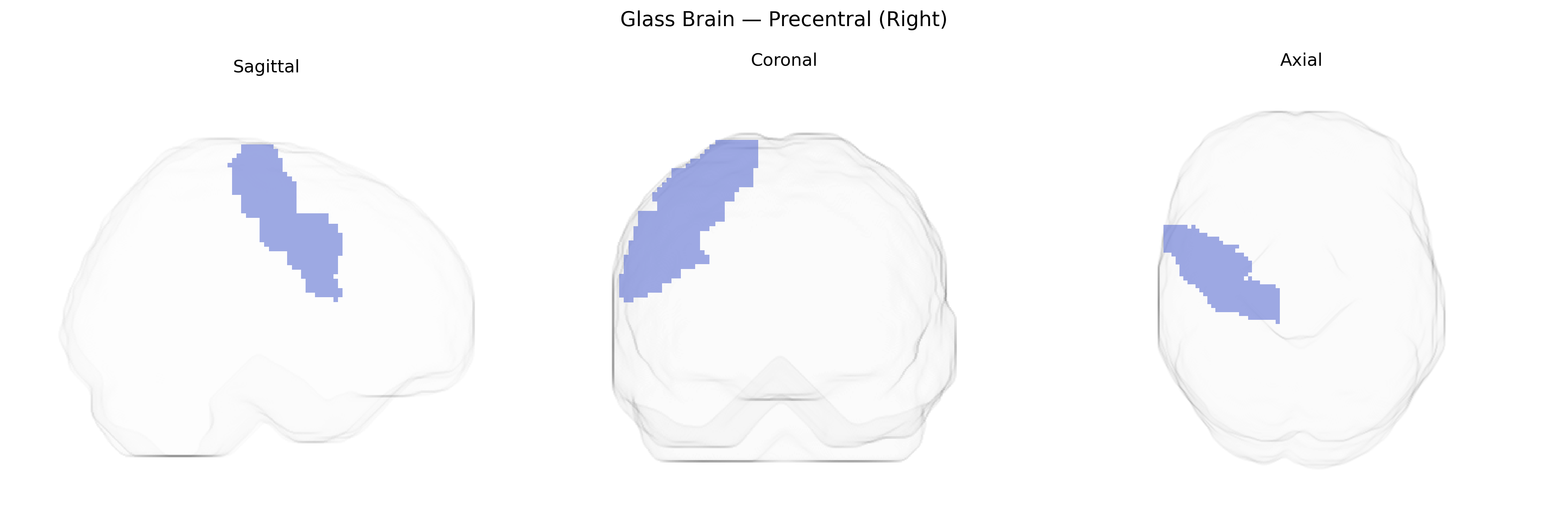 Triplanar Ghost Brain