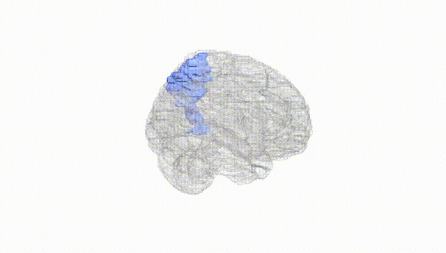 Full Brain White
