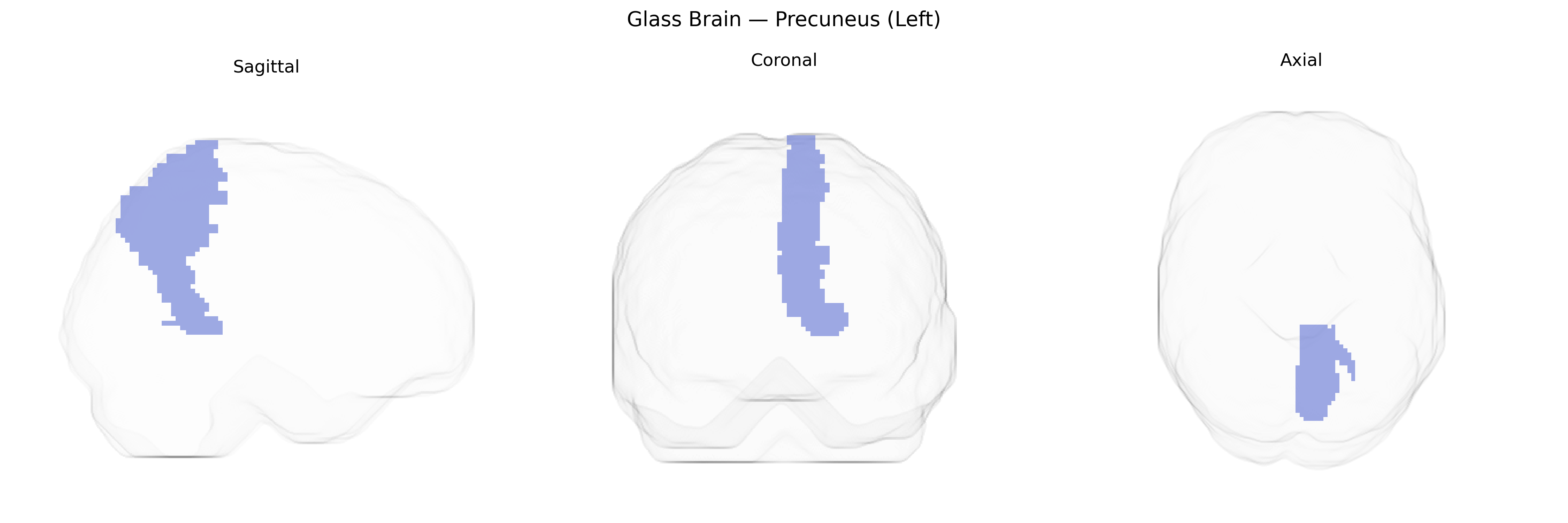 Triplanar Ghost Brain