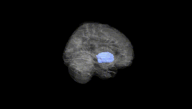 Full Brain Black