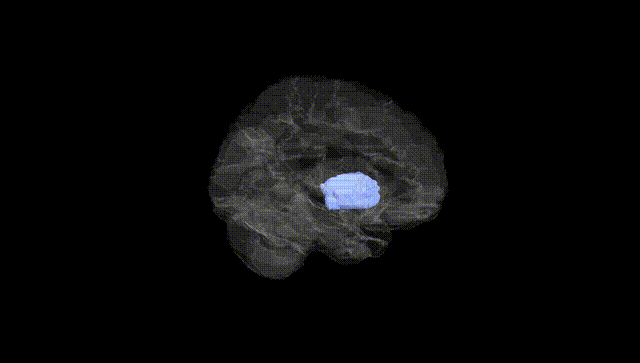Hemisphere Black