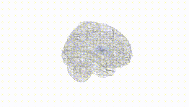 Full Brain White