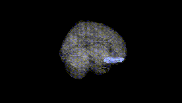 Full Brain Black