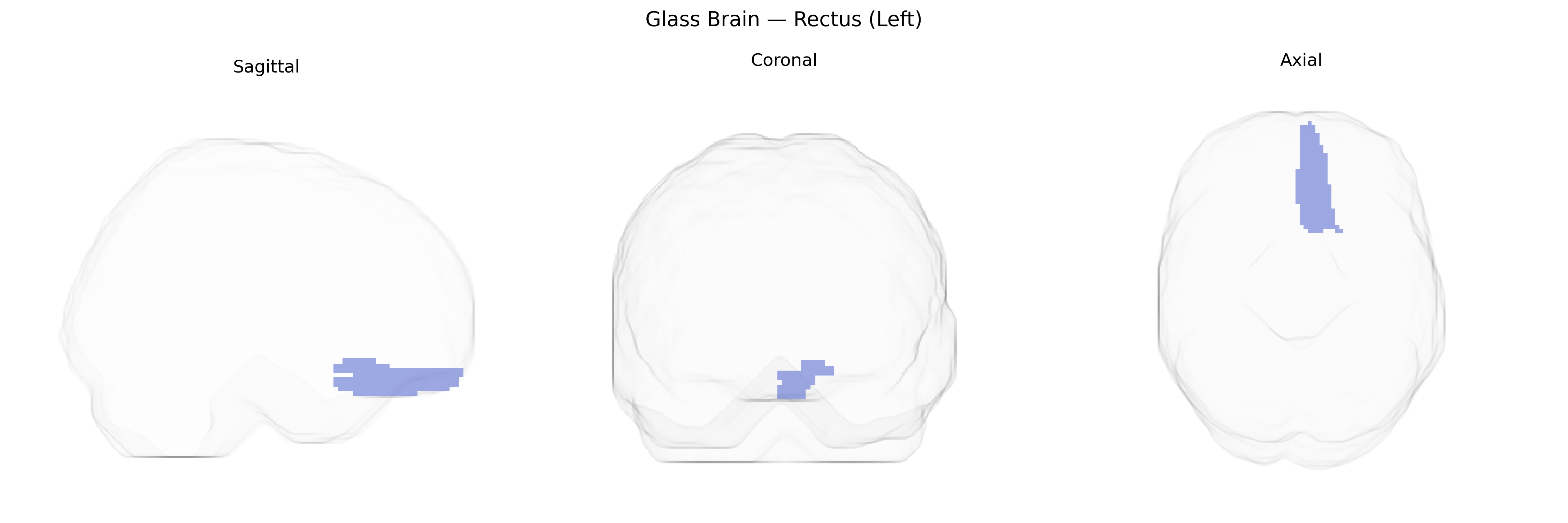 Triplanar Ghost Brain