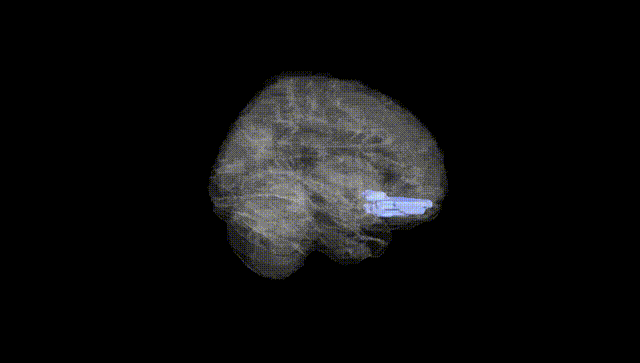 Full Brain Black