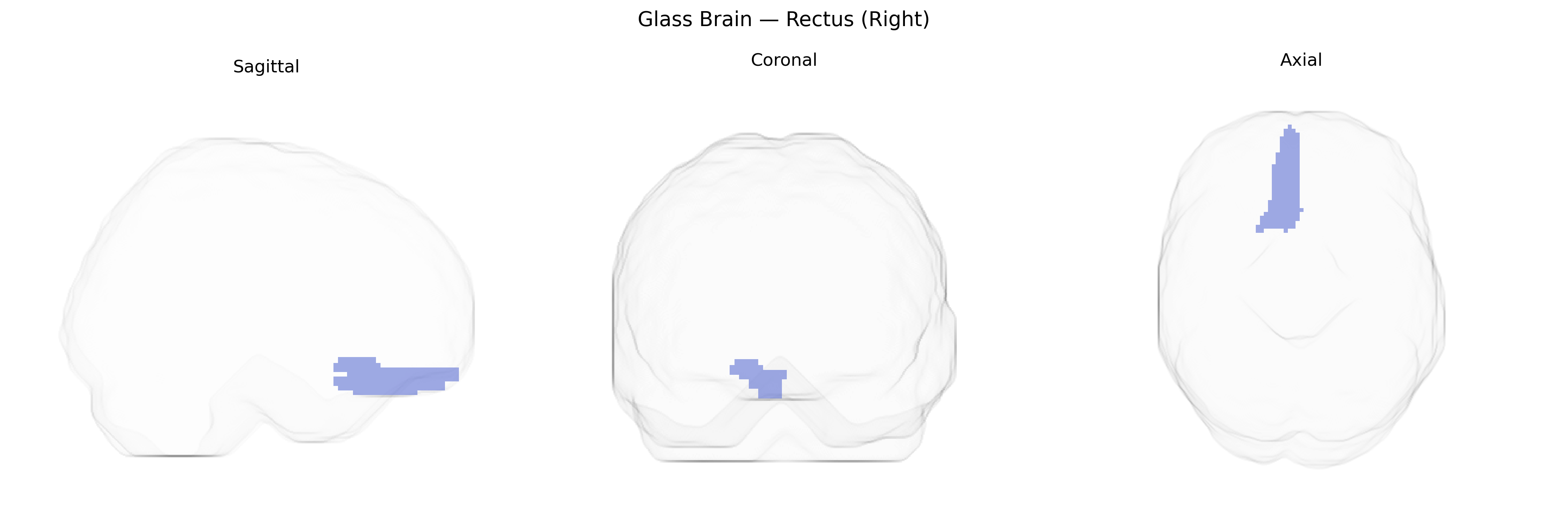 Triplanar Ghost Brain