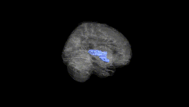 Full Brain Black