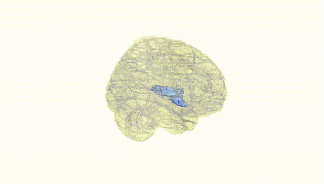 Full Brain White