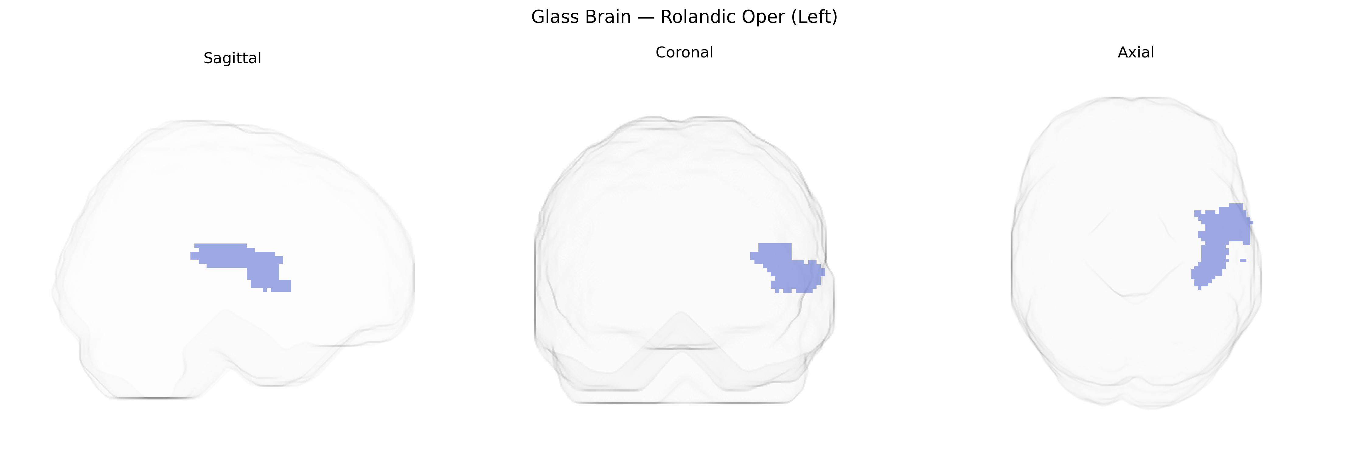 Triplanar Ghost Brain