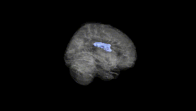 Full Brain Black