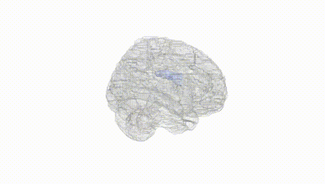 Full Brain White