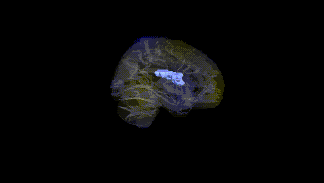 Hemisphere Black