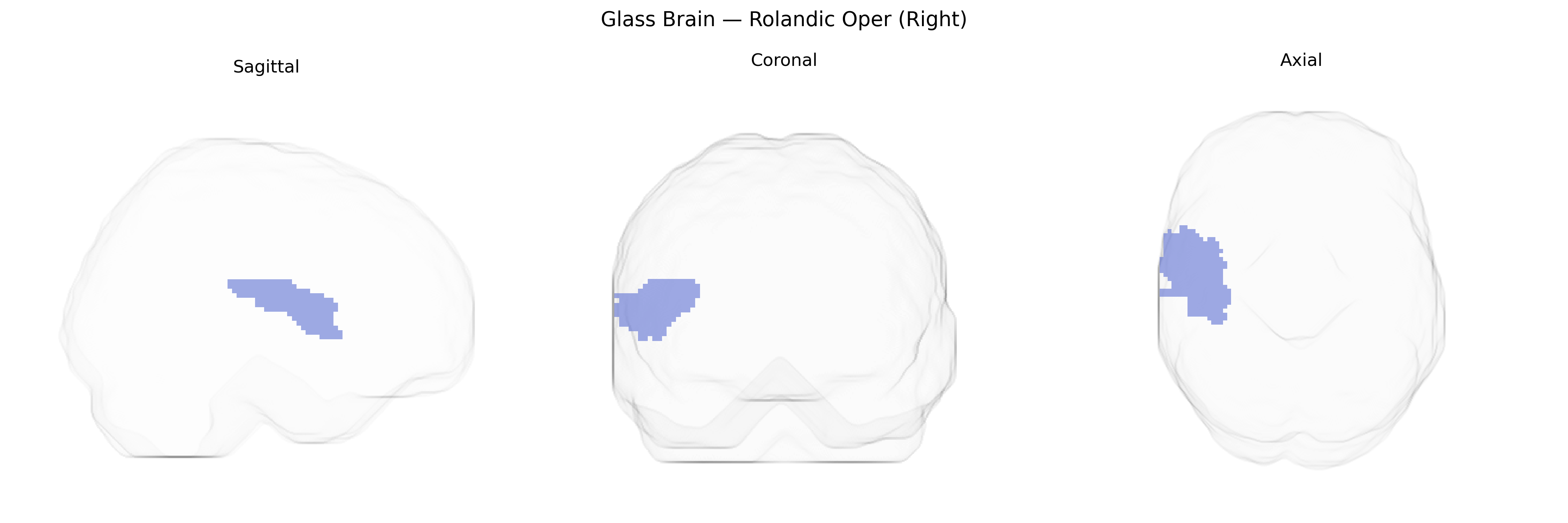 Triplanar Ghost Brain
