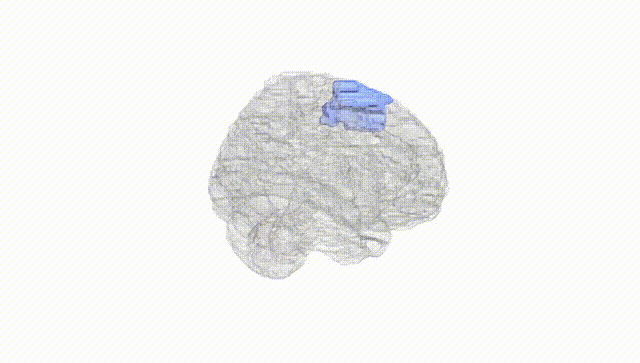 Full Brain White