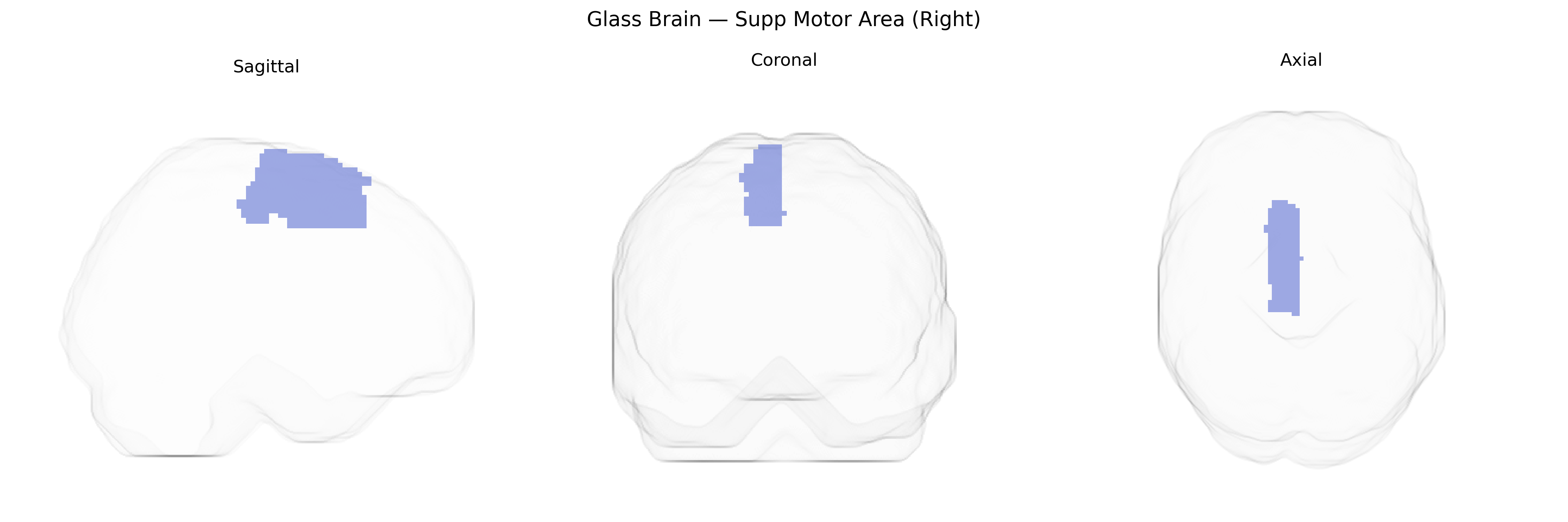 Triplanar Ghost Brain