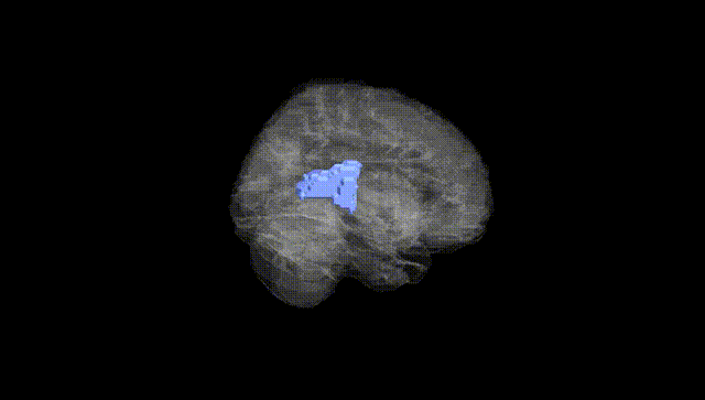 Full Brain Black