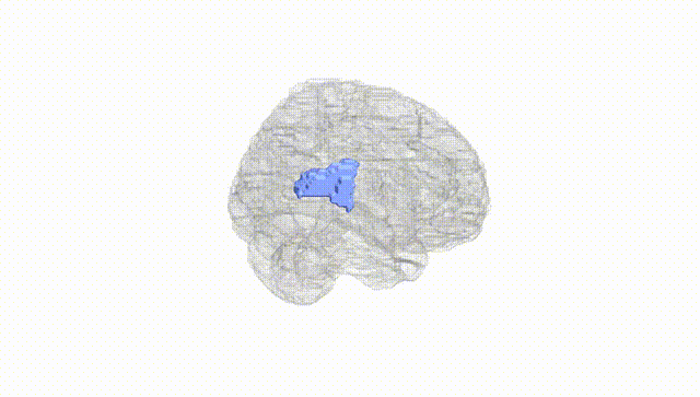 Full Brain White