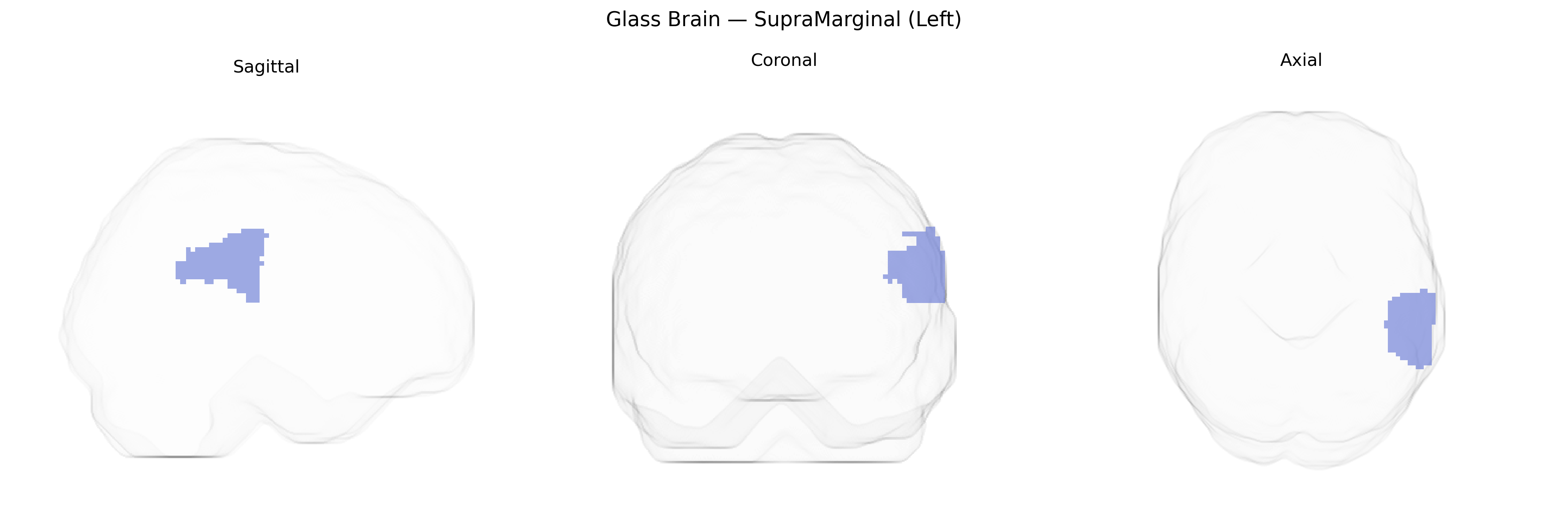 Triplanar Ghost Brain