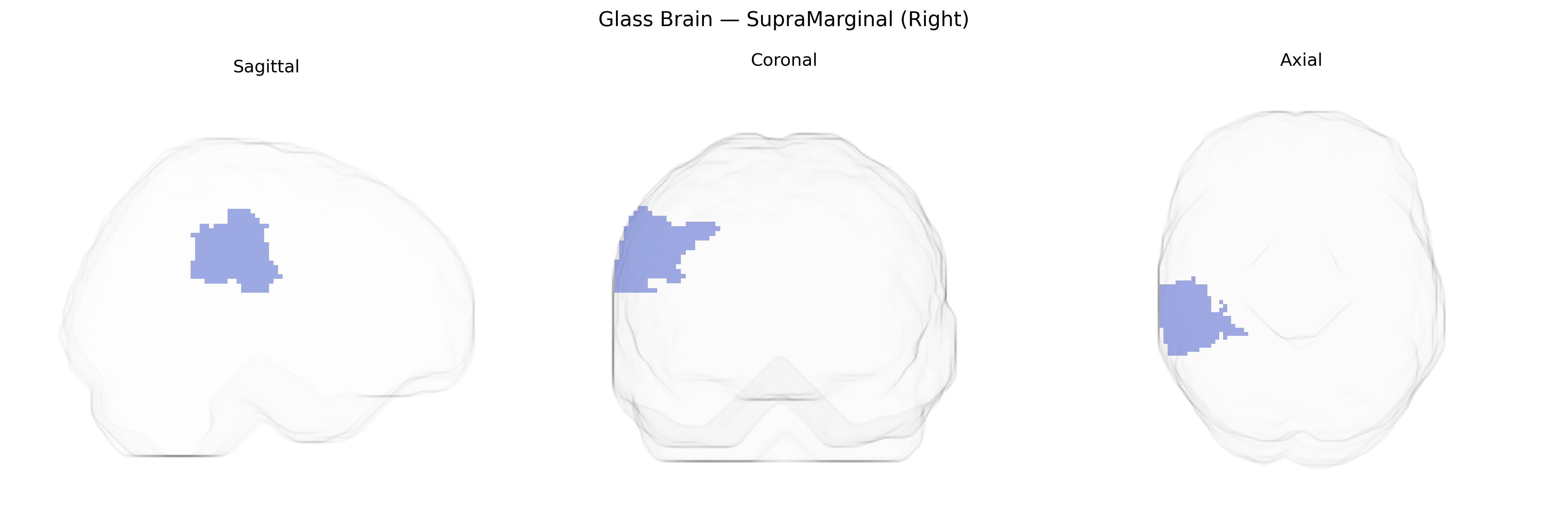 Triplanar Ghost Brain