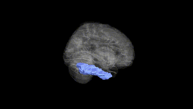 Full Brain Black