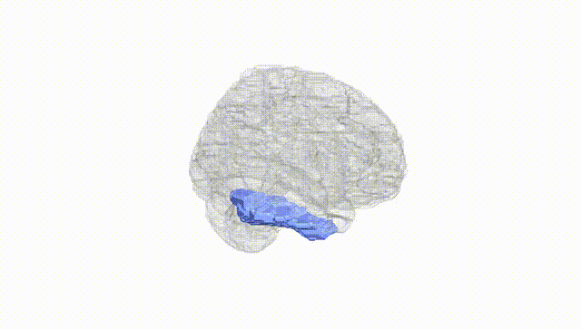 Full Brain White