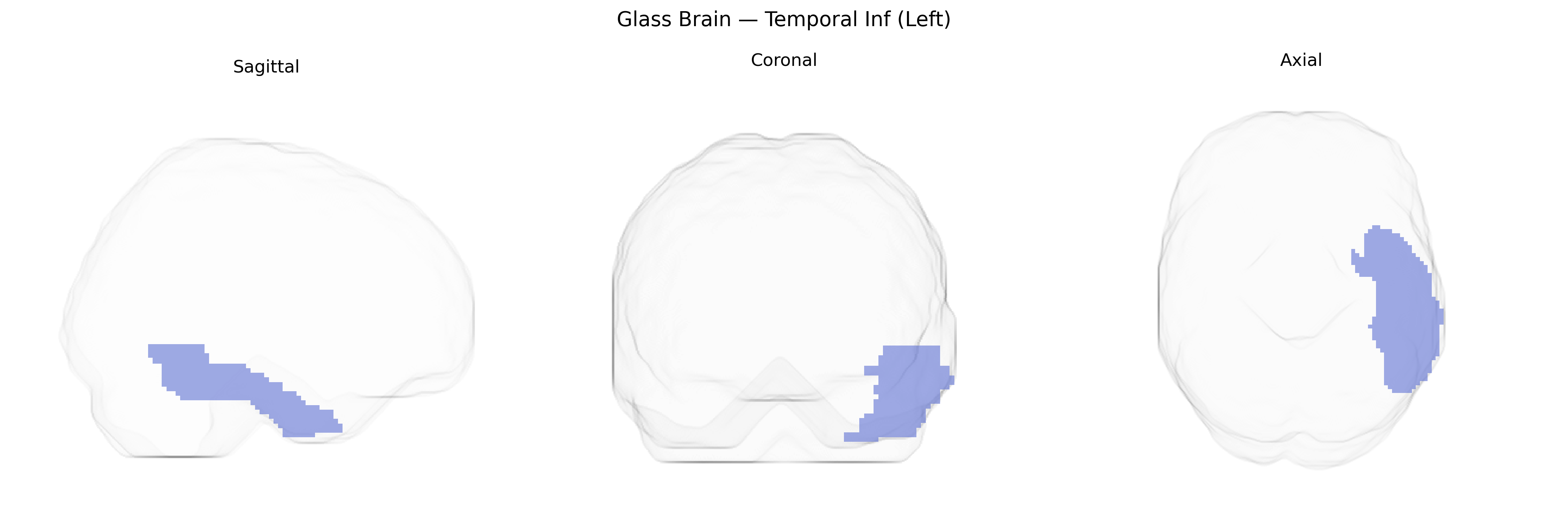 Triplanar Ghost Brain