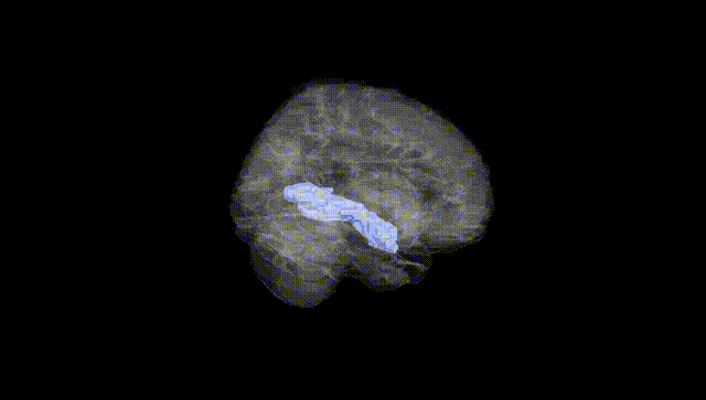 Full Brain Black