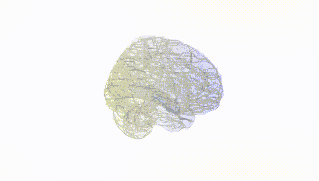 Full Brain White