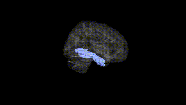 Hemisphere Black