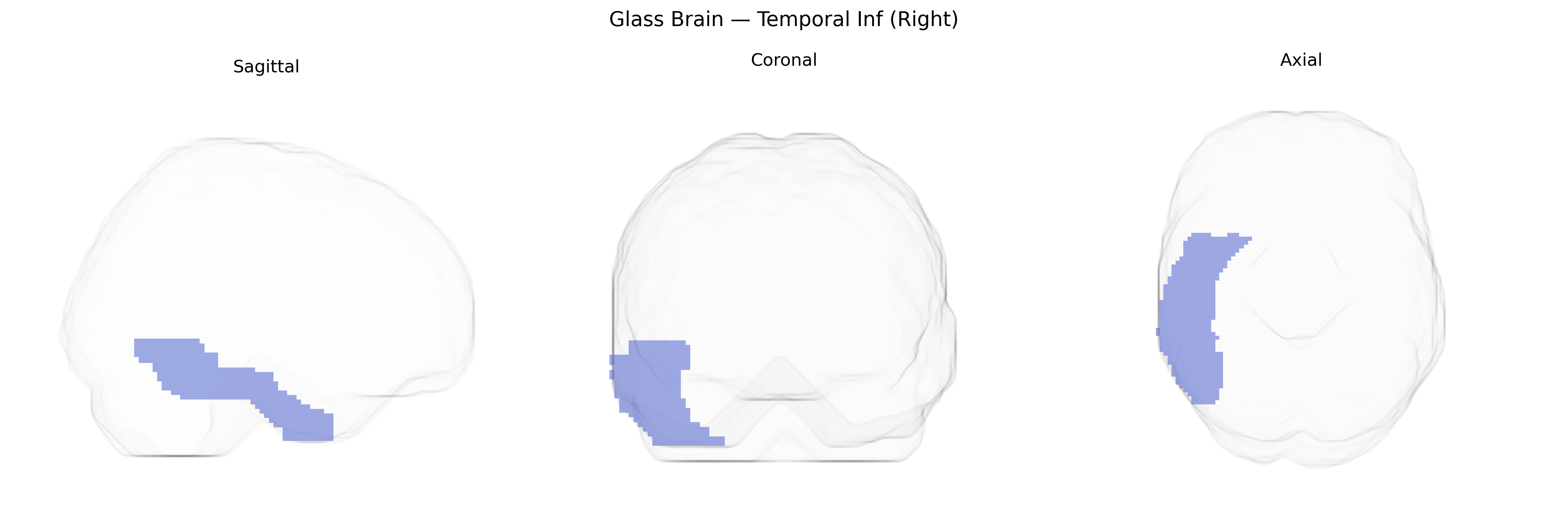 Triplanar Ghost Brain