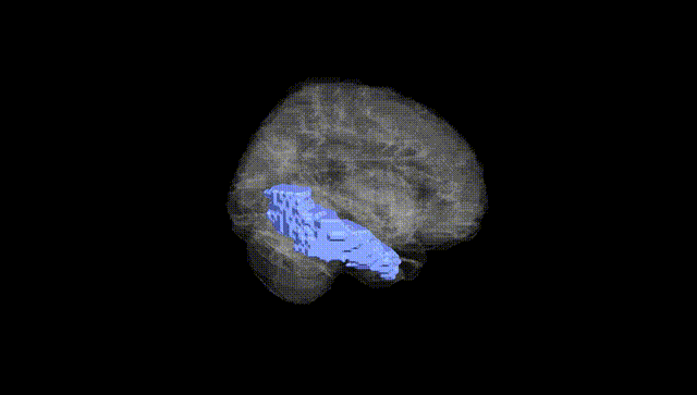 Full Brain Black