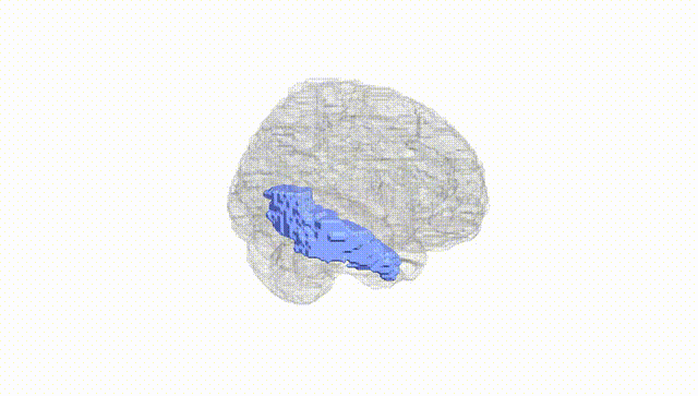 Full Brain White