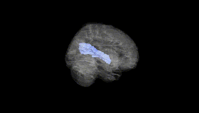 Full Brain Black