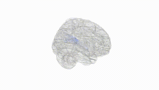 Full Brain White