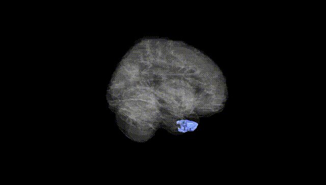 Full Brain Black
