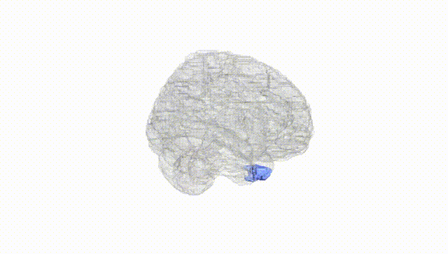 Full Brain White
