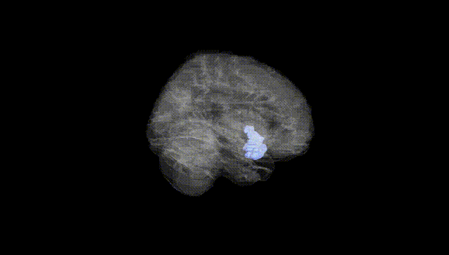 Full Brain Black